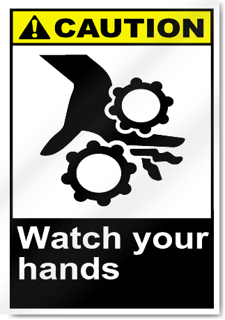 Watch Your Hands Caution Signs